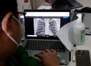 Pemerintah Siapkan Skema Perlindungan Sosial untuk Pasien TBC, Target Tuntas 2030